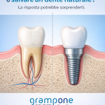 N. 25 – Impianto o dente naturale? Cosa conviene davvero | Studio Grampone